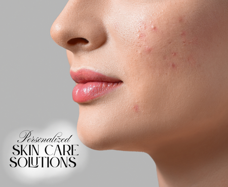 Skin Care Solutions 1